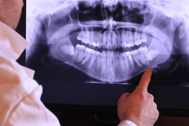 Best Walk-In Emergency Dentist in Troy, MO